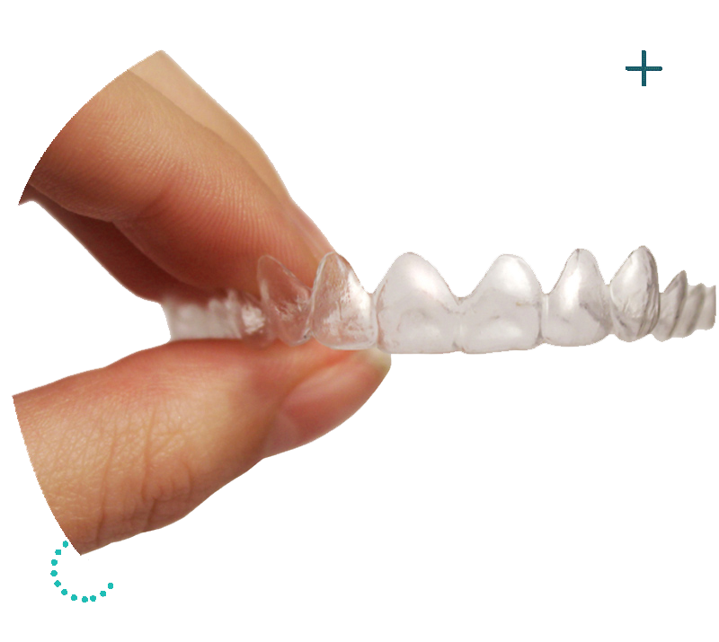 Invisible Braces In Singapore