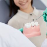 3 Reasons For Teeth Extraction Before Braces Treatment