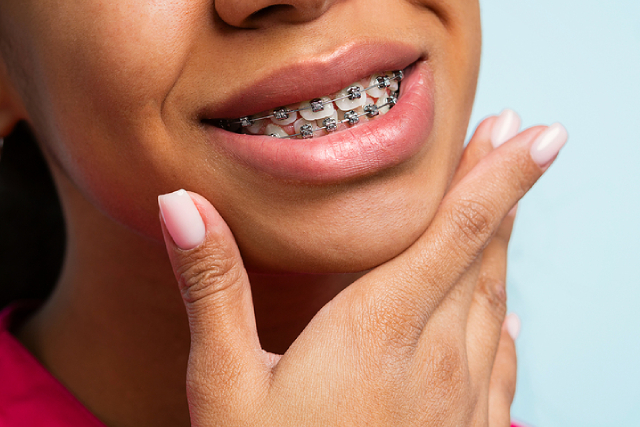 Orthodontist Treatment Options for an Overbite