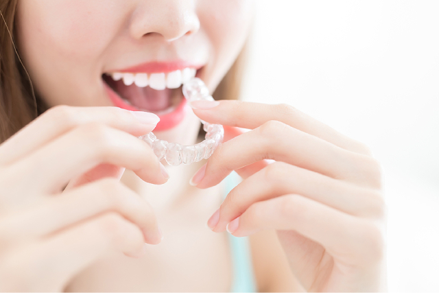 5 Must-Have Accessories When Getting Invisalign Treatment