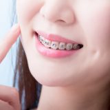 How To Choose Between Invisible Braces & Traditional Braces