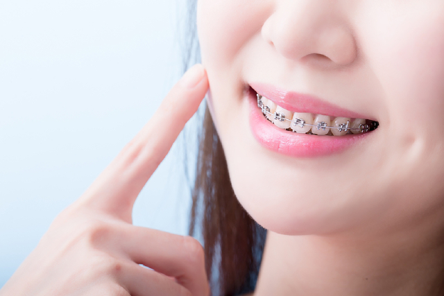 How To Choose Between Invisible Braces & Traditional Braces