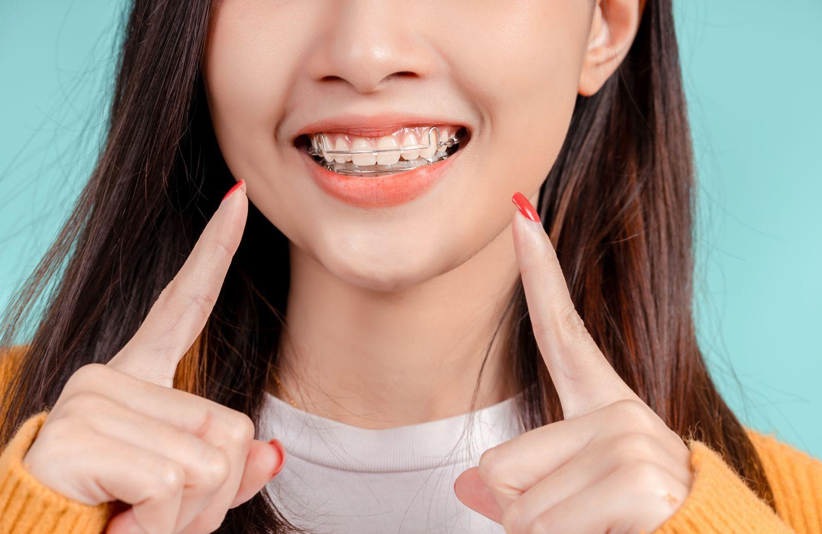 Overcoming Braces Anxiety