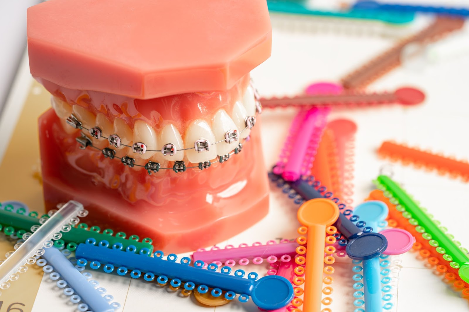 How Do Braces Work? Everything You Need To Know
