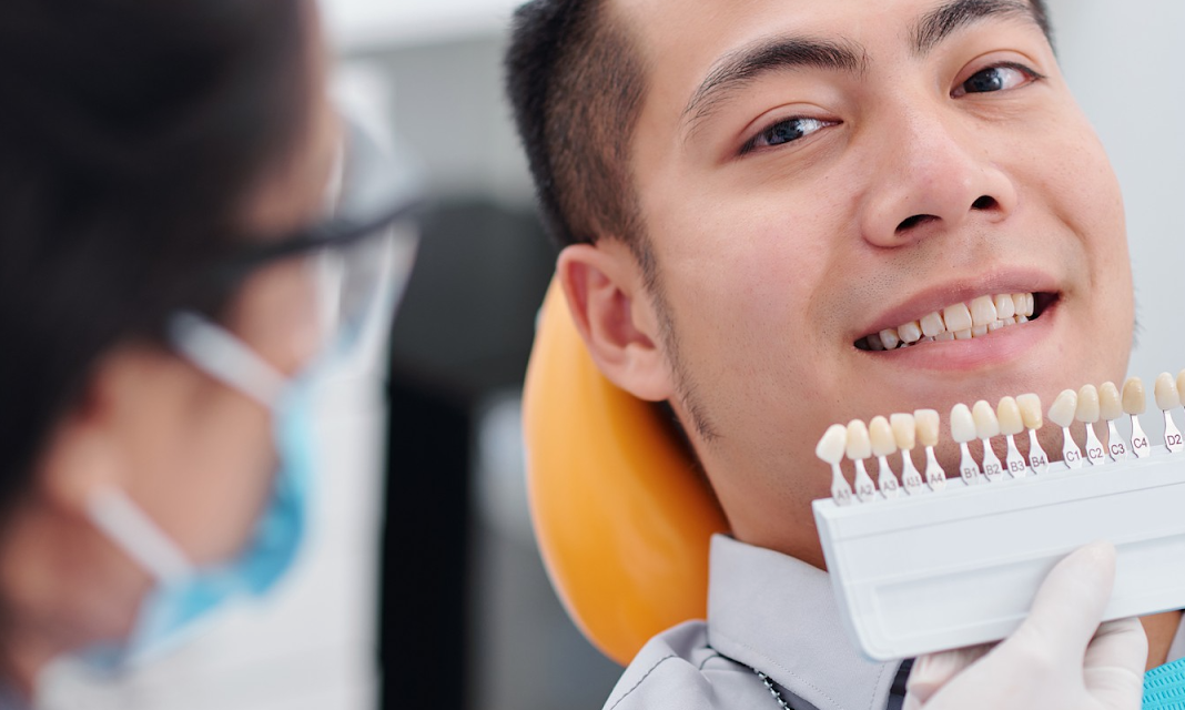 What Are Dental Veneers? Everything You Need To Know