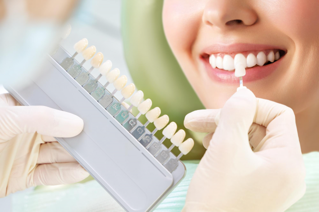 What is the procedure for getting dental veneers
