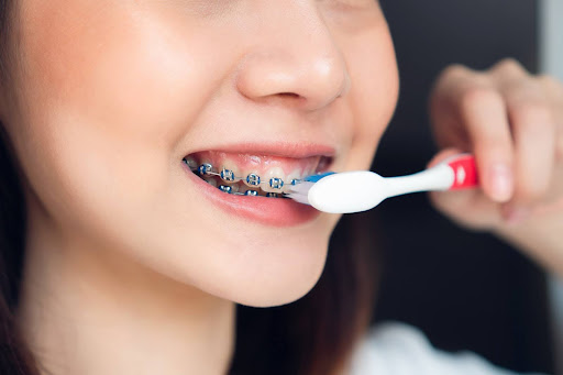 Braces Girl Brushing Her Teeth