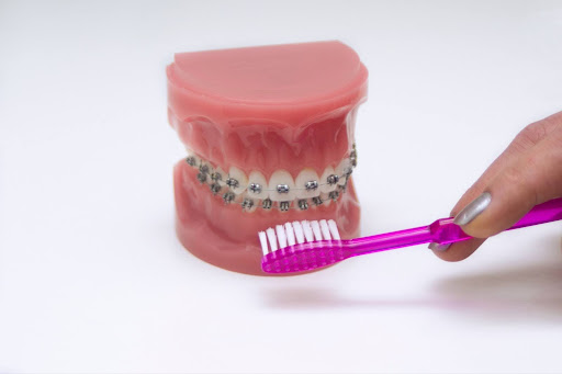 Proper brushing techniques for braces