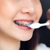 Toothbrush for Braces