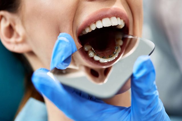 dentist checking patient lingual braces