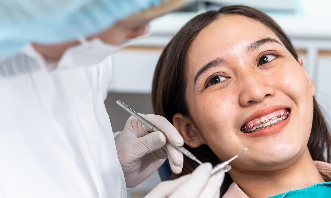 5 Reasons Why Singapore Is the Better Choice for Braces, Even if Braces in Malaysia Seem Cheaper