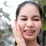 Braces Mouth Sore