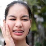 Braces Mouth Sore