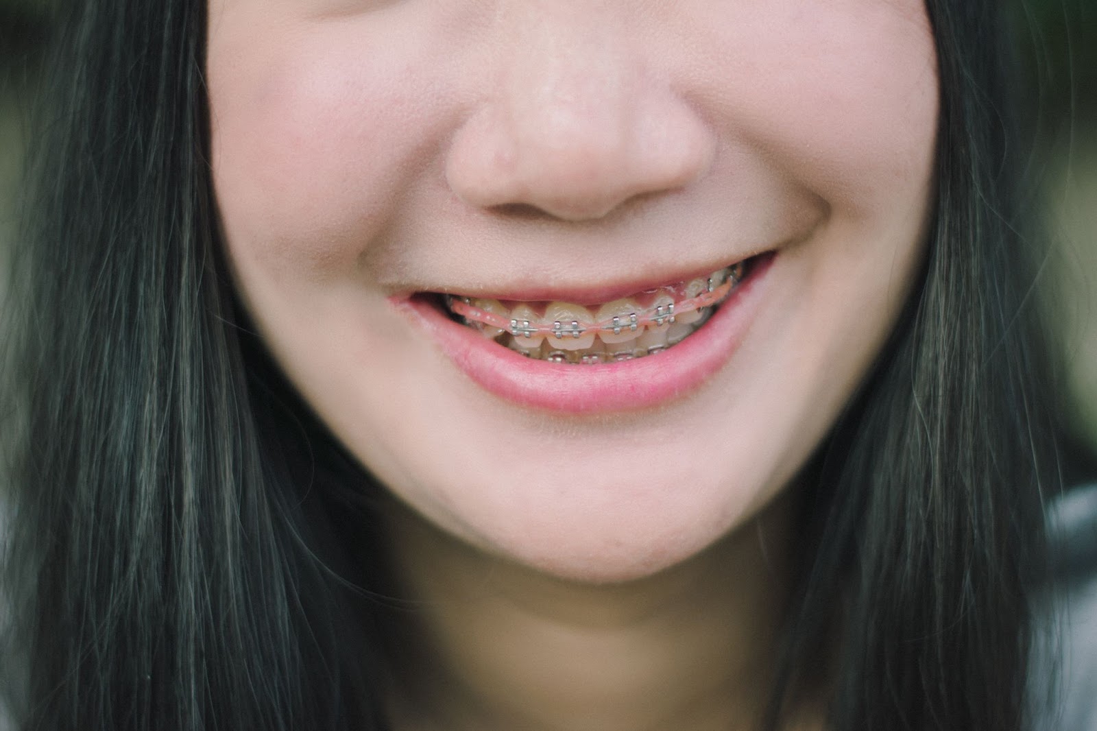 braces during pregnancy when to begin
