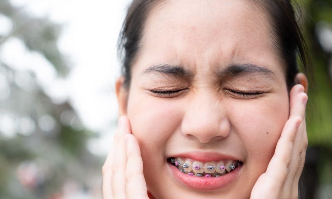 Dealing with Mouth Ulcers While Wearing Braces: Prevention and Soothing Tips