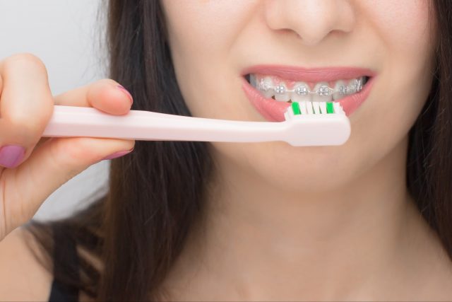 Tips to Maintain Braces and Gums