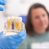 Dental Implant in Singapore