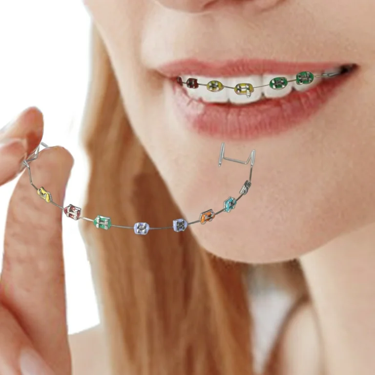 What Are Fashion Braces, DIY Braces, and Online Aligners?
